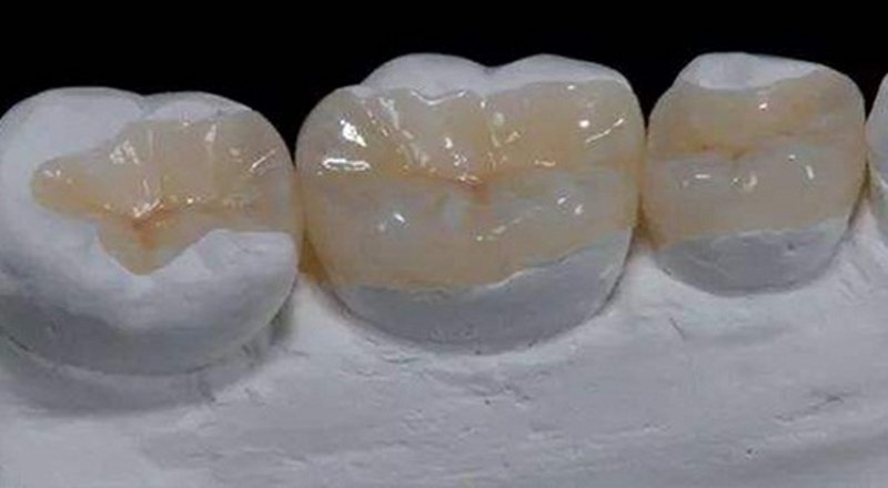 解决口腔难题：南京的高效治疗案例分析